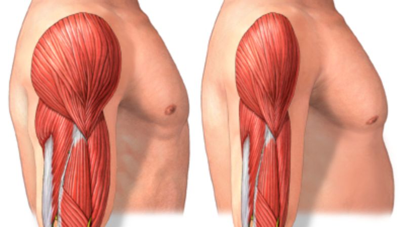 عضله سوزی بدنسازان